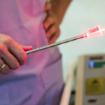 Что такое гинекологический вагинальный лазер?